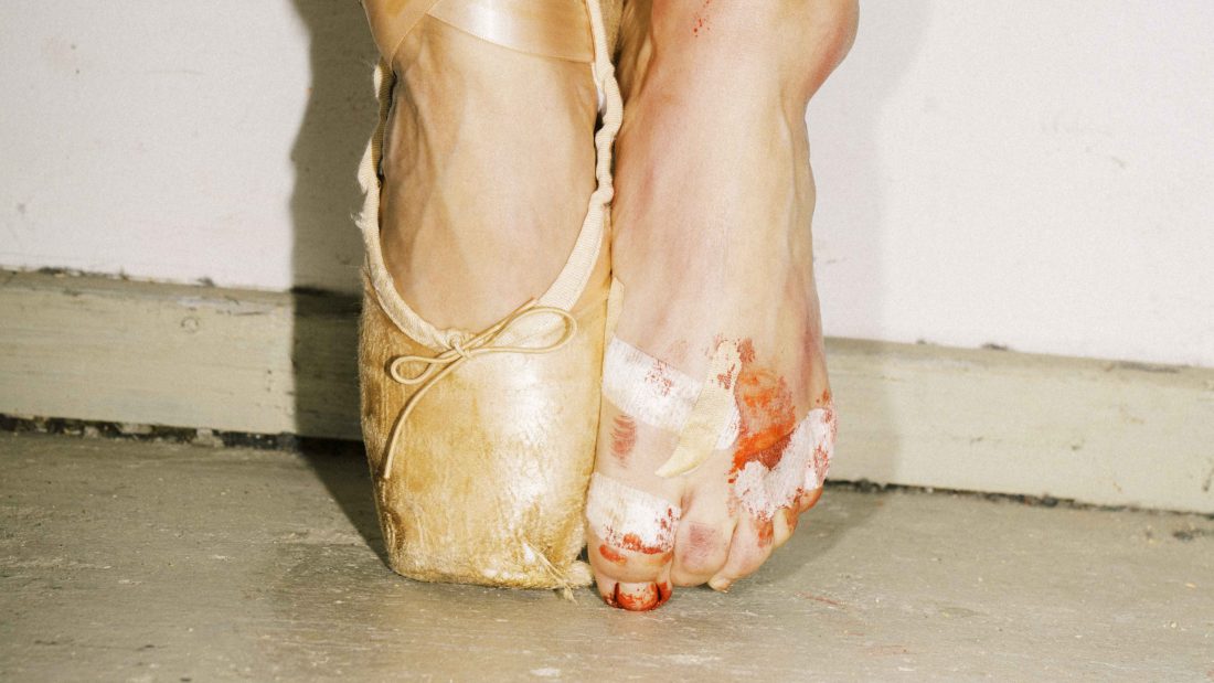 two feet, one in balletshoes, one bloddy and with plasters 
